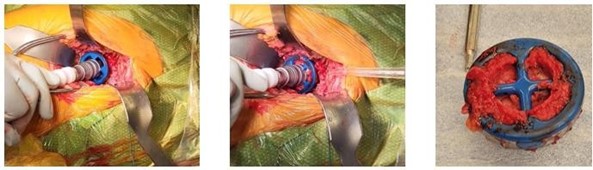 Sales Training and Surgical Tips