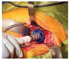Sales Training and Surgical Tips