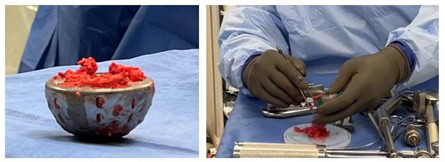 Sales Training and Surgical Tips